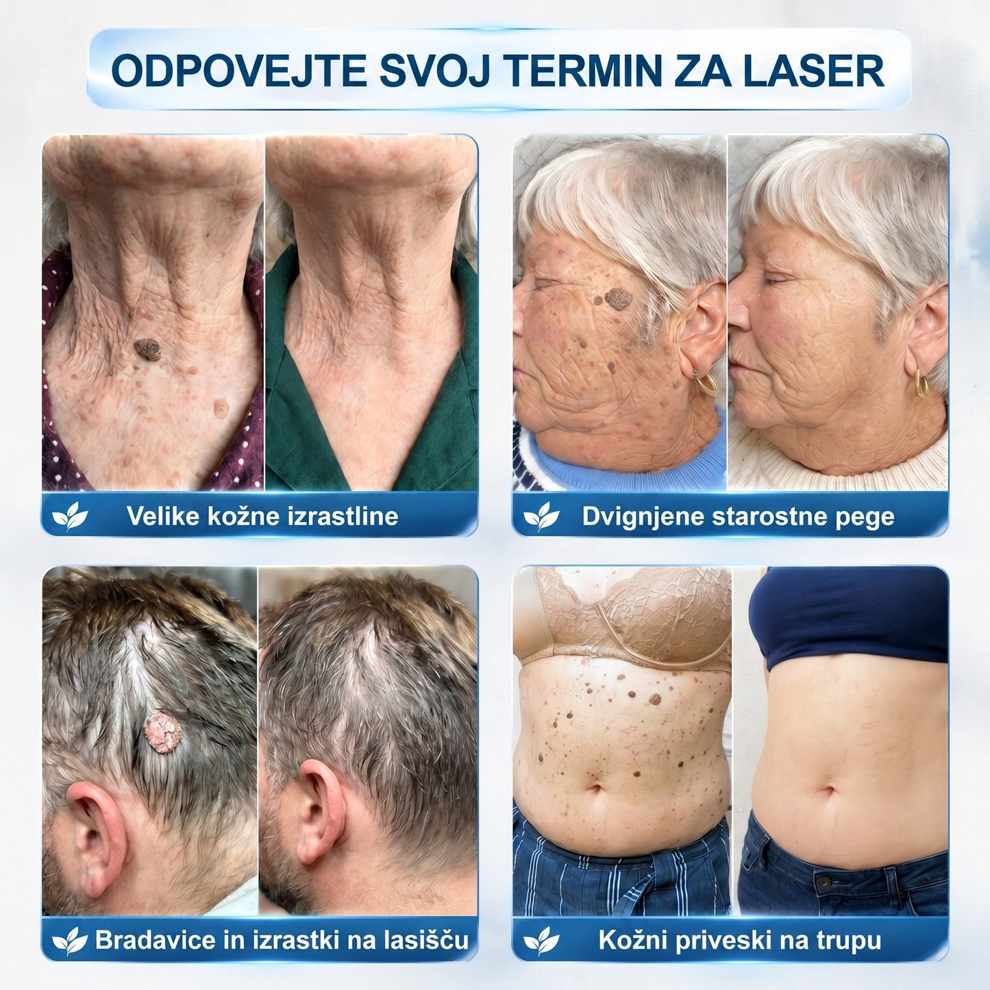 🏥💯𝐏𝒊𝐜𝐝𝒐® 7-𝑫𝒏𝒆𝒗𝒏𝒊 𝑶𝒅𝒔𝒕𝒓𝒂𝒏𝒋𝒆𝒗𝒂𝒏𝒋𝒆 𝑷𝒊𝒈𝒎𝒆𝒏𝒕𝒏𝒊𝒉 𝑴𝒂𝒅𝒆ž𝒆𝒗 𝑰𝒏 𝑩𝒓𝒂𝒛𝒈𝒐𝒕𝒊𝒏 𝑷𝒊𝒔𝒂𝒍𝒐