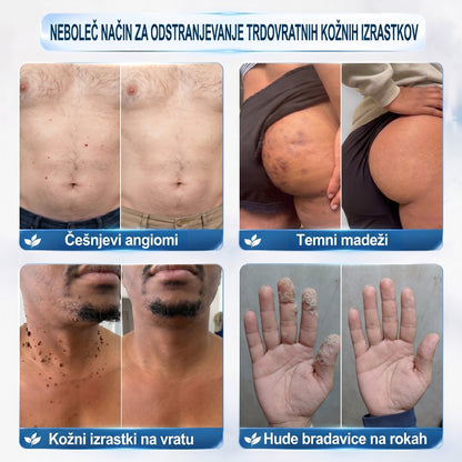 🏥💯𝐏𝒊𝐜𝐝𝒐® 7-𝑫𝒏𝒆𝒗𝒏𝒊 𝑶𝒅𝒔𝒕𝒓𝒂𝒏𝒋𝒆𝒗𝒂𝒏𝒋𝒆 𝑷𝒊𝒈𝒎𝒆𝒏𝒕𝒏𝒊𝒉 𝑴𝒂𝒅𝒆ž𝒆𝒗 𝑰𝒏 𝑩𝒓𝒂𝒛𝒈𝒐𝒕𝒊𝒏 𝑷𝒊𝒔𝒂𝒍𝒐